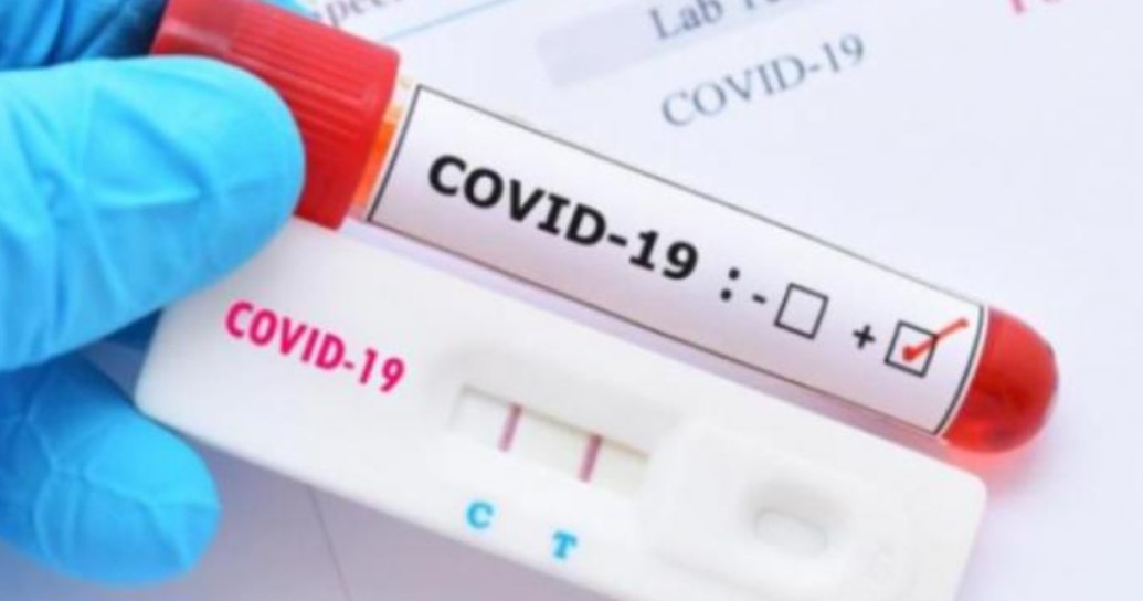 При направени 2373 теста и поставени 144 ваксини през изминалия